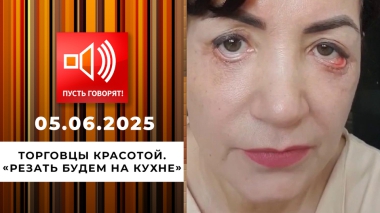 Торговцы красотой. Эпизод 3: «Резать будем на кухне». Пусть говорят. Выпуск от 05.06.2025